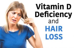 Vitamin D Deficiency and Hair Loss | Is Your Thinning Hair Caused By